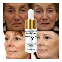 Cargar imagen en el visor de la galería, LANBENA Tratamiento de poros Esencia Reduce los poros, Tratamiento para el acné Removedor Nariz Piel con espinillas Reafirmante Hidratante Suero facial Cuidado de la piel
